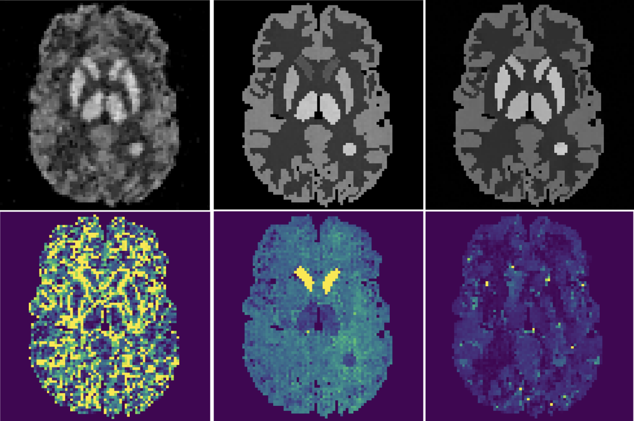 Bayesian PET Reconstruction with Learned Normalizing Flow Priors
